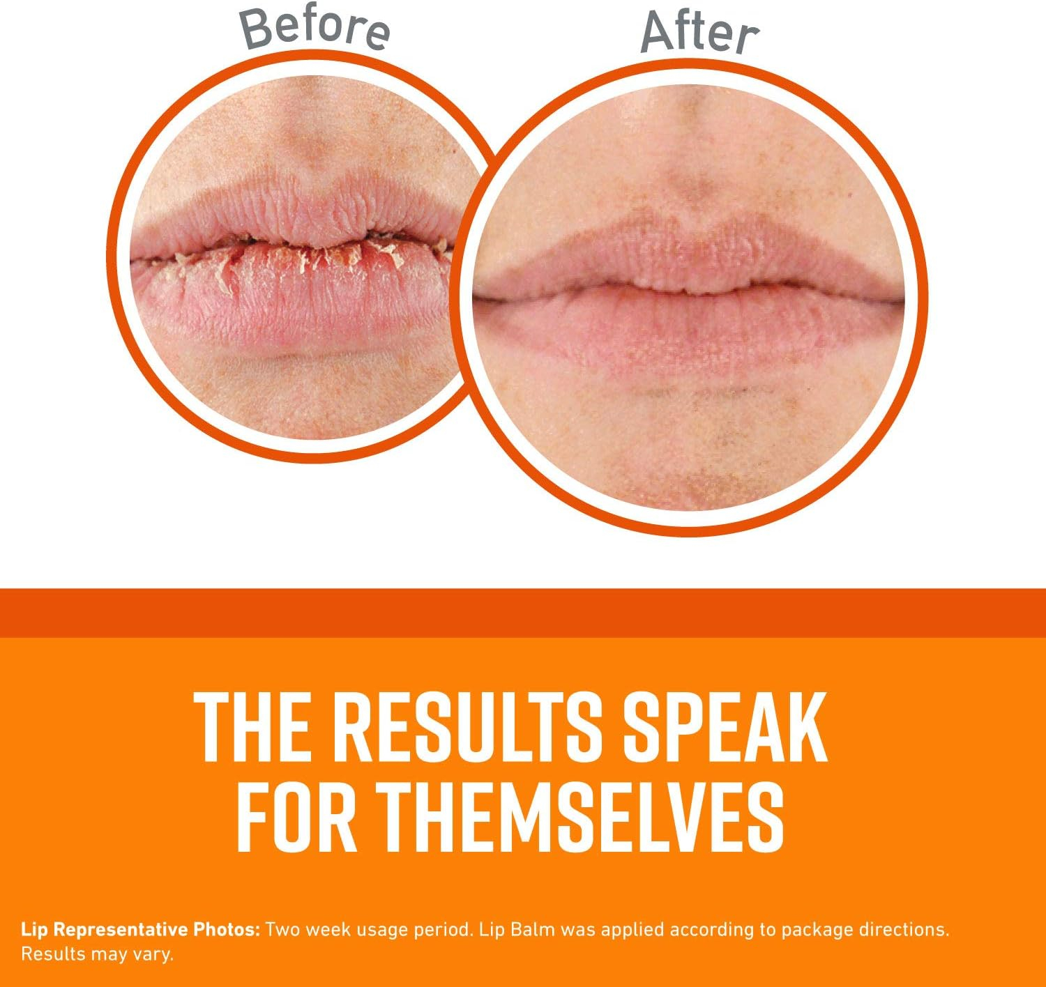 O'Keeffe's Lip Repair 8 Hour Hydration, Soothing Aloeboost, Citrus Infused, Lip Balm for Dry Cracked Lips, Stick, 0.15 oz / 4.2 g, (Pack of 1), K1900002 - Image 5