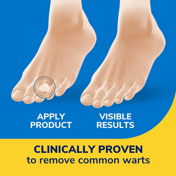 Dr Scholl's Duragel Clearaway Wart Remover - Image 4